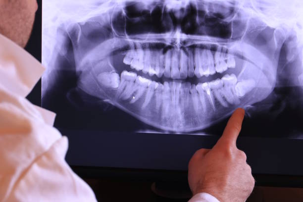 Best Emergency Dental Services for Seniors in Wildwood, MO